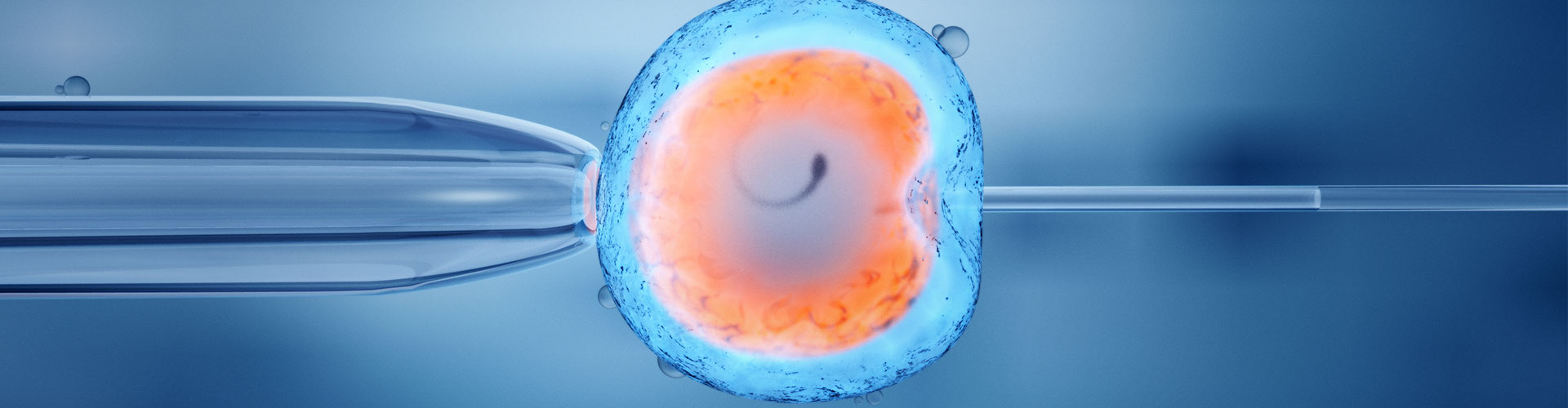 In Vitro Fertilization & Embryo Transfer in New Jersey | Infertility Docs