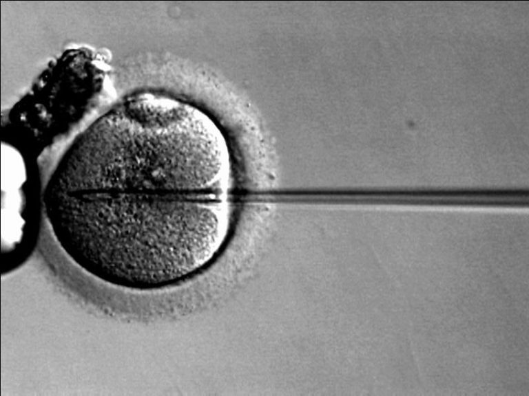 What is ICSI? Intracytoplasmic Sperm Injection To Help with Male